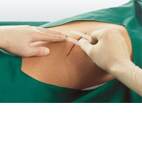 Smith & Nephew Leukostrip Wundnahtstreifen 4 x 38 mm, Box